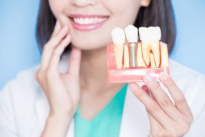 dentist holding a model of dental implants in West Bloomfield 